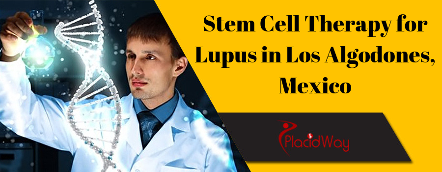 Stem Cell Therapy for Lupus in Los Algodones, Mexico